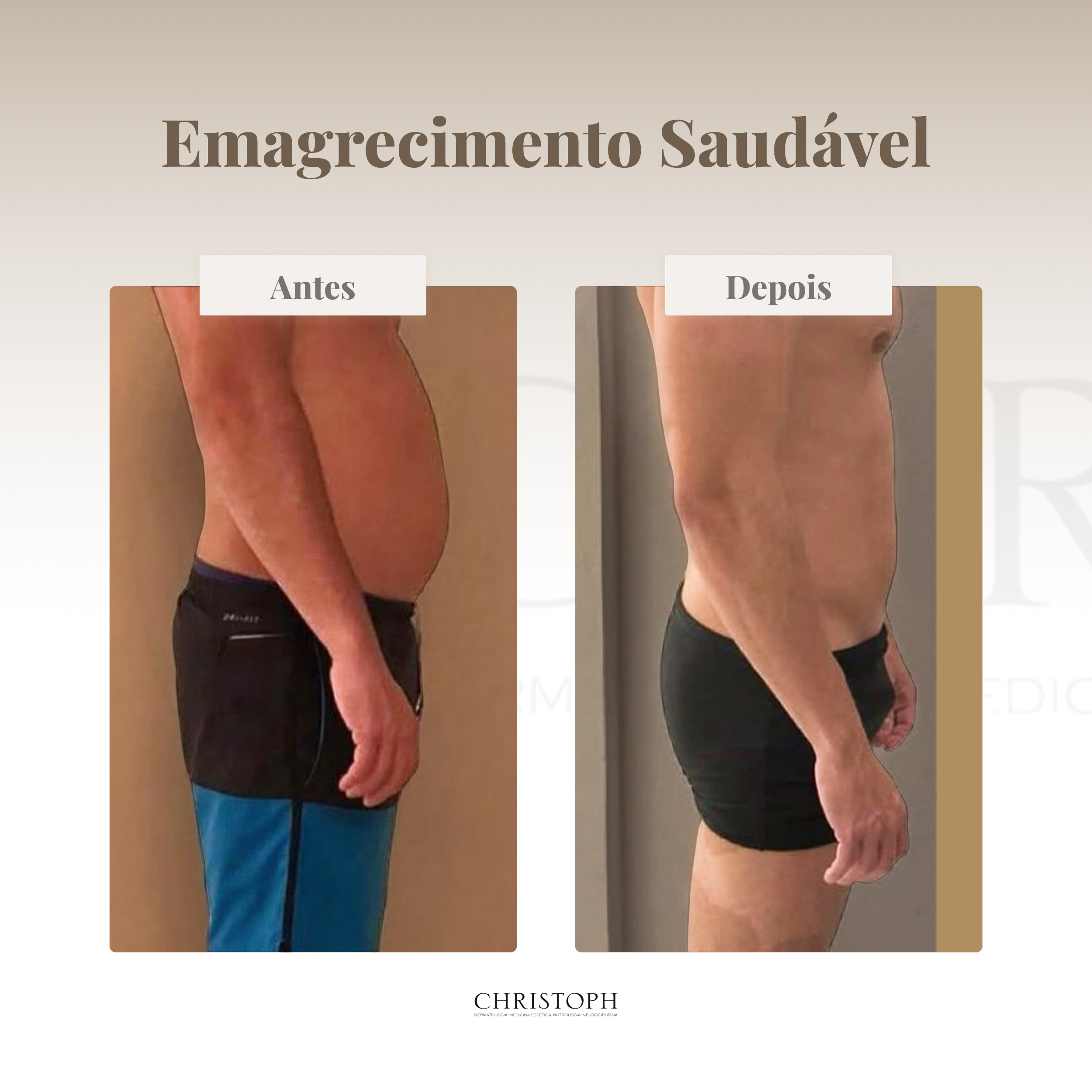 Emagrecimento Saudável