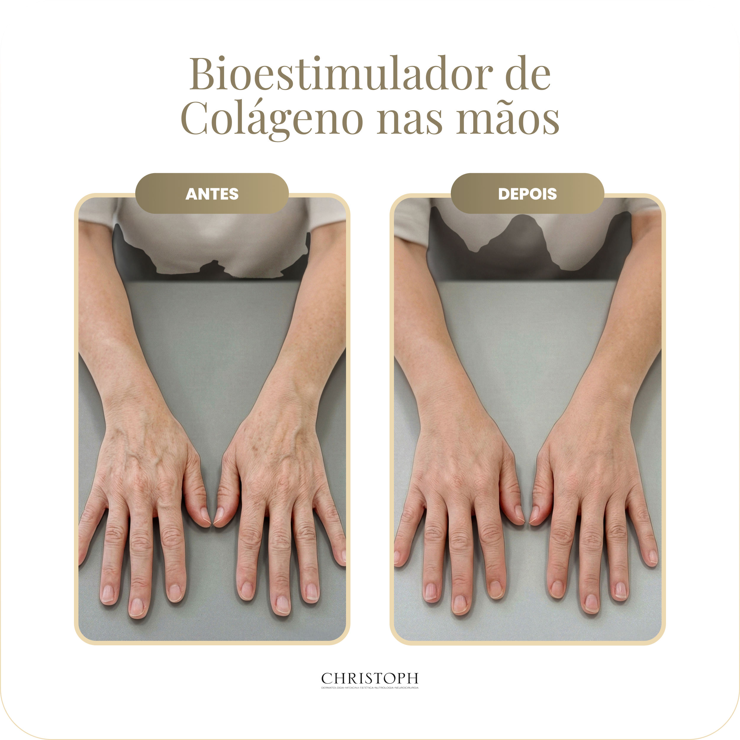 bioestimulador_de_col_geno_nas_m_os