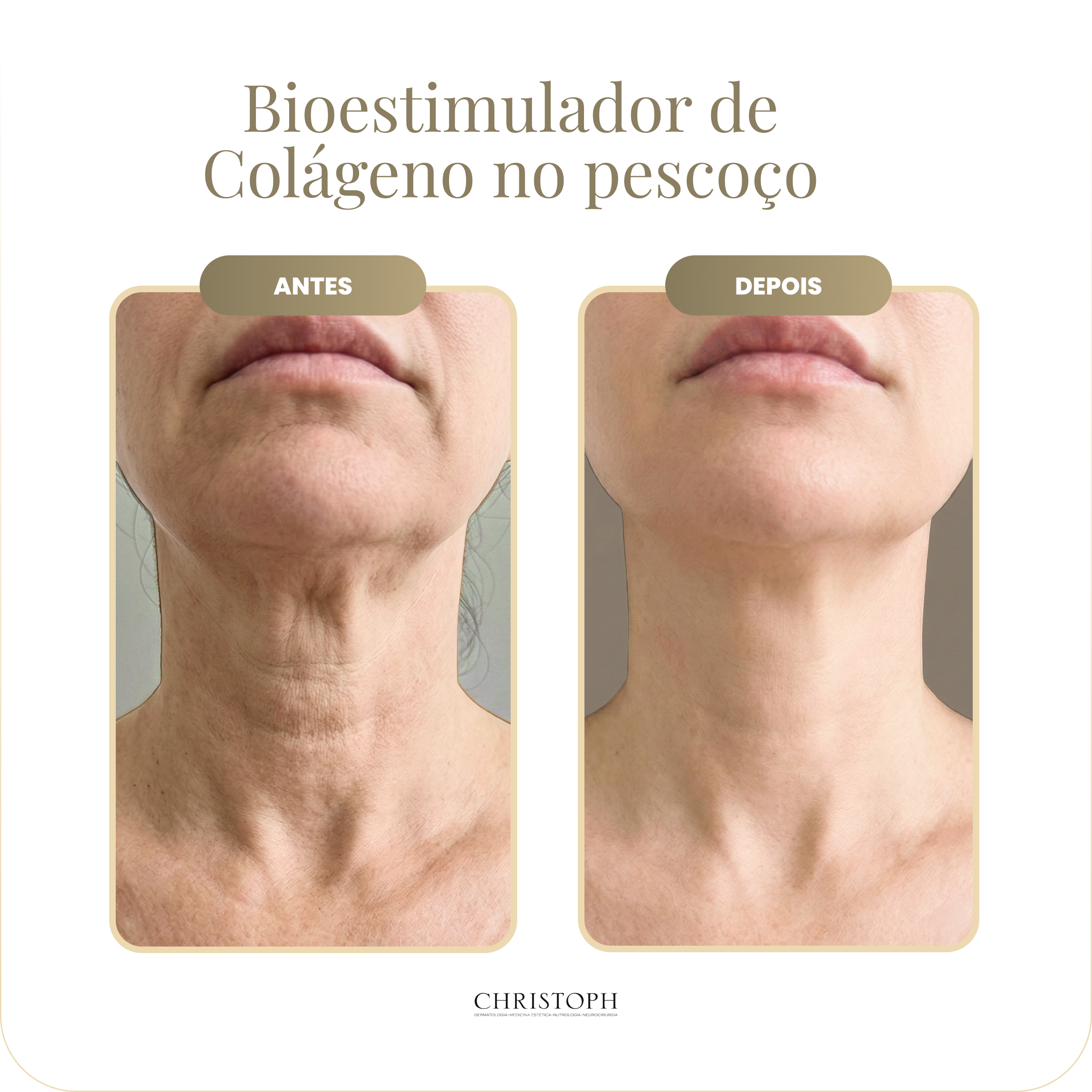 bioestimulador_de_col_geno_no_pesco_o